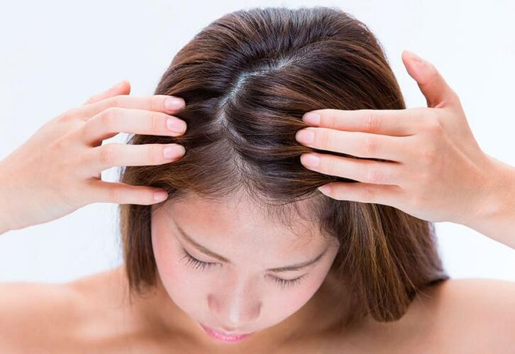 Psoriasis treatment